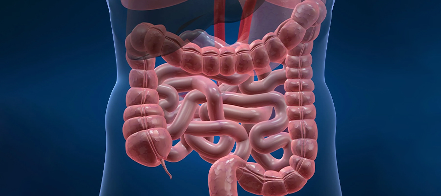 Síntomas de intestino permeable: señales que no debes ignorar
