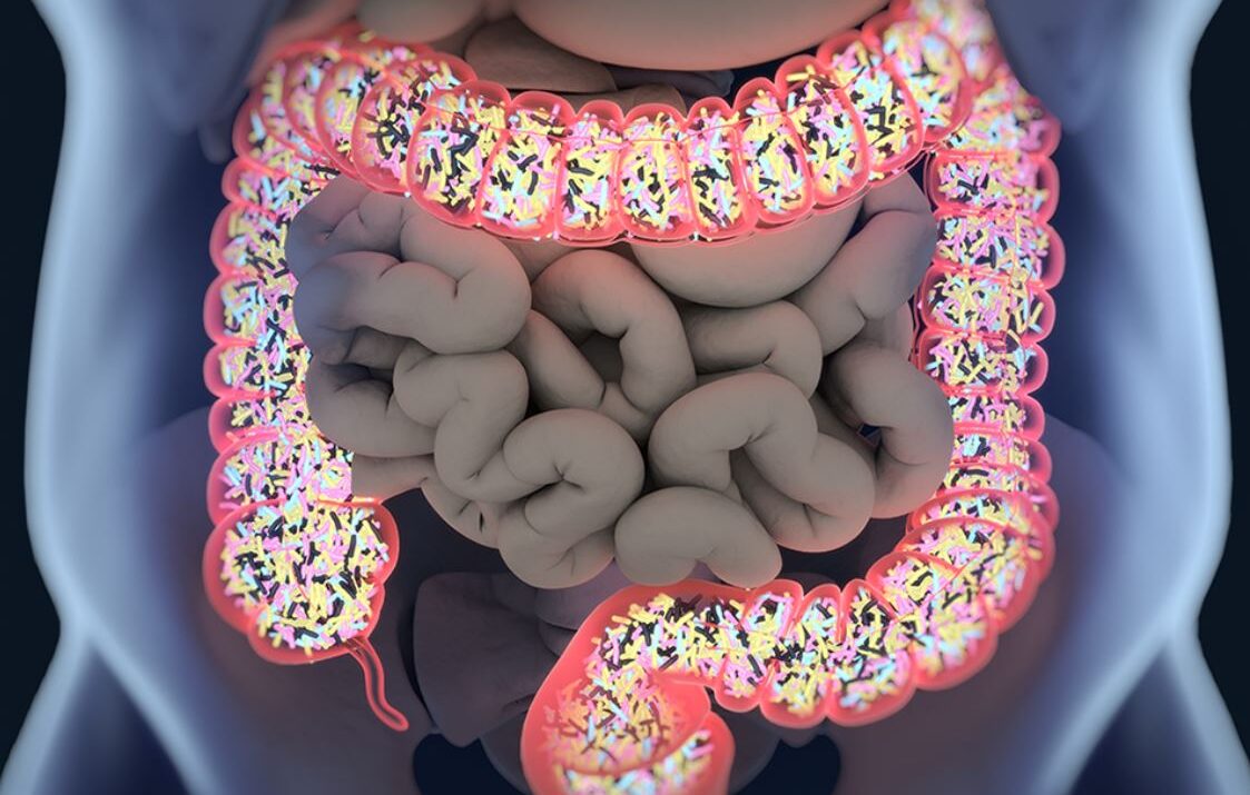 Cómo mejorar la microbiota intestinal de forma natural