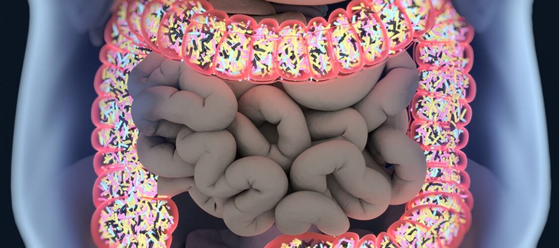 Alimentos fermentados para la microbiota intestinal